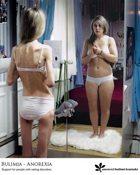 anorexia-y-bulimia1.jpg